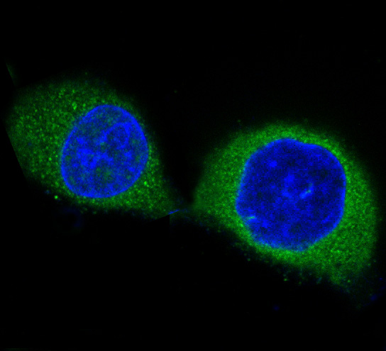 3 - Anti-PDPK1/Pdk 1 Rabbit Monoclonal Antibody ABO13688