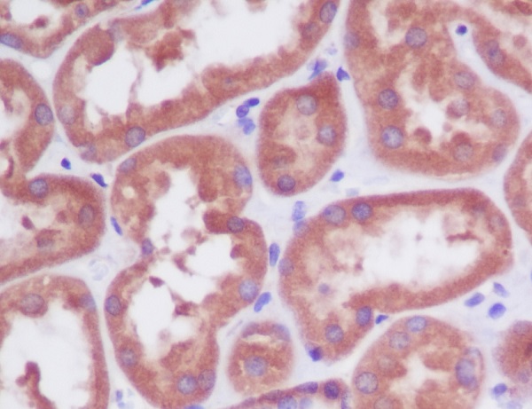 2 - Anti-PDPK1/Pdk 1 Rabbit Monoclonal Antibody ABO13688