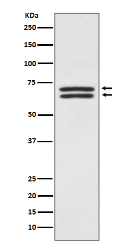 1 - Anti-PDPK1/Pdk 1 Rabbit Monoclonal Antibody ABO13688