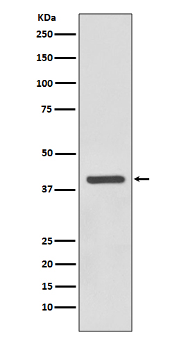 1 - Anti-SIRT6 Rabbit Monoclonal Antibody ABO13690