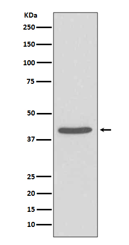 1 - Anti-SIRT2/Sirtuin 2 Rabbit Monoclonal Antibody ABO13691