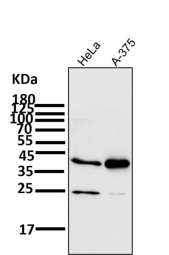 1 - Anti-SIRT2/Sirtuin 2 Rabbit Monoclonal Antibody ABO13691