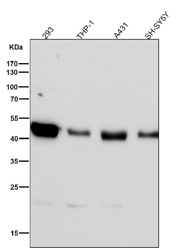 1 - Anti-SIRT2/Sirtuin 2 Rabbit Monoclonal Antibody ABO13691