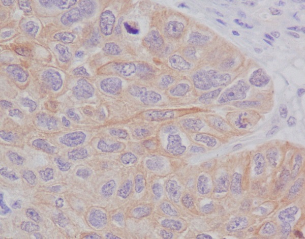 2 - Anti-STAT2 Rabbit Monoclonal Antibody ABO13692