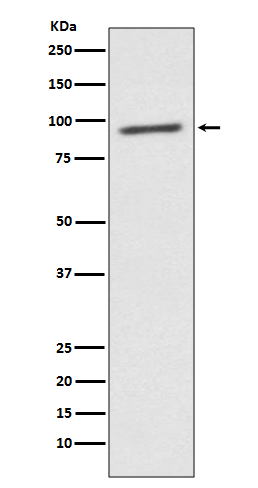 1 - Anti-STAT2 Rabbit Monoclonal Antibody ABO13692