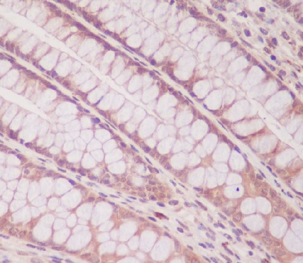 2 - Anti-Smad1 Rabbit Monoclonal Antibody ABO13694