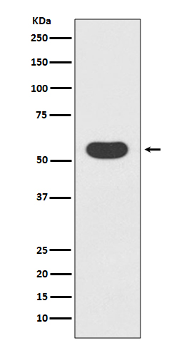 1 - Anti-Smad1 Rabbit Monoclonal Antibody ABO13694