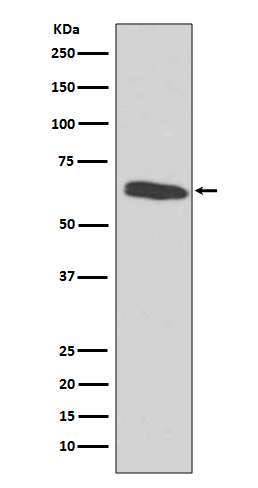 1 - Anti-HDAC2/Histone Deacetylase 2 Rabbit Monoclonal Antibody ABO13695