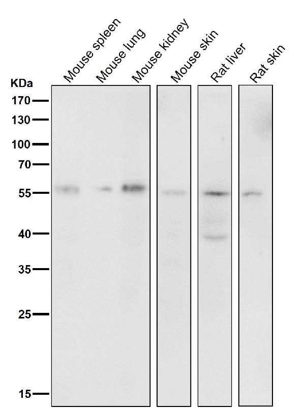 1 - Anti-HDAC2/Histone Deacetylase 2 Rabbit Monoclonal Antibody ABO13695