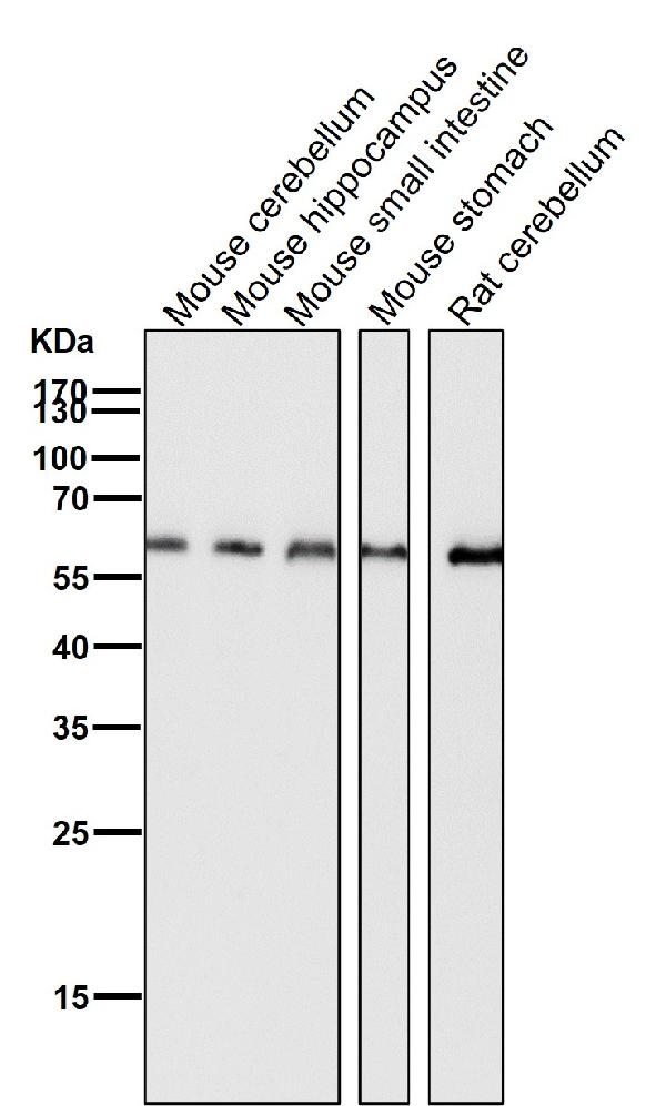 1 - Anti-HDAC2/Histone Deacetylase 2 Rabbit Monoclonal Antibody ABO13695