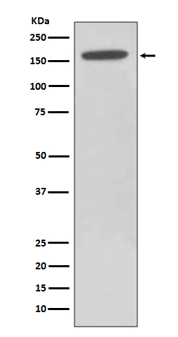 1 - Anti-HDAC6/Histone Deacetylase 6 Rabbit Monoclonal Antibody ABO13696