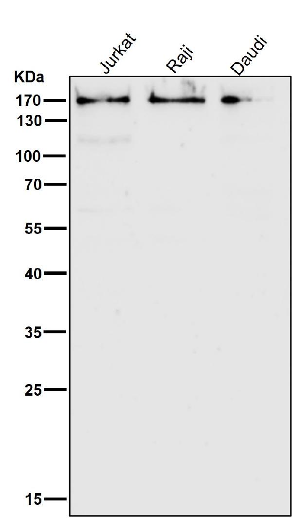 1 - Anti-HDAC6/Histone Deacetylase 6 Rabbit Monoclonal Antibody ABO13696