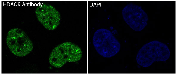 3 - Anti-HDAC9 Rabbit Monoclonal Antibody ABO13697