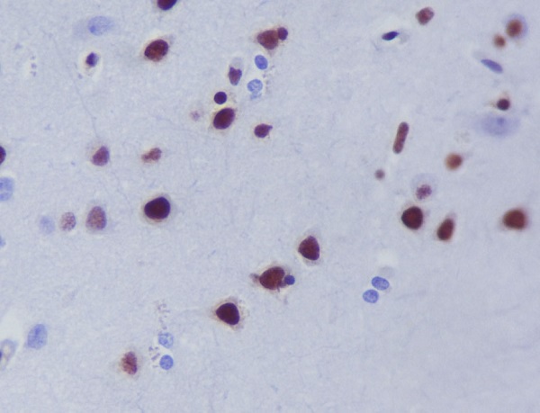 2 - Anti-HDAC9 Rabbit Monoclonal Antibody ABO13697