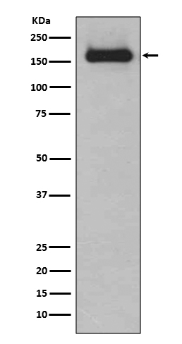 1 - Anti-HDAC9 Rabbit Monoclonal Antibody ABO13697