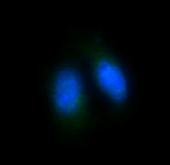 3 - Anti-FoxO4/Afx Rabbit Monoclonal Antibody ABO13698