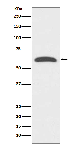1 - Anti-FoxO4/Afx Rabbit Monoclonal Antibody ABO13698