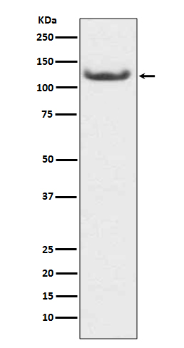 1 - Anti-HDAC7/Histone Deacetylase 7 Rabbit Monoclonal Antibody ABO13700