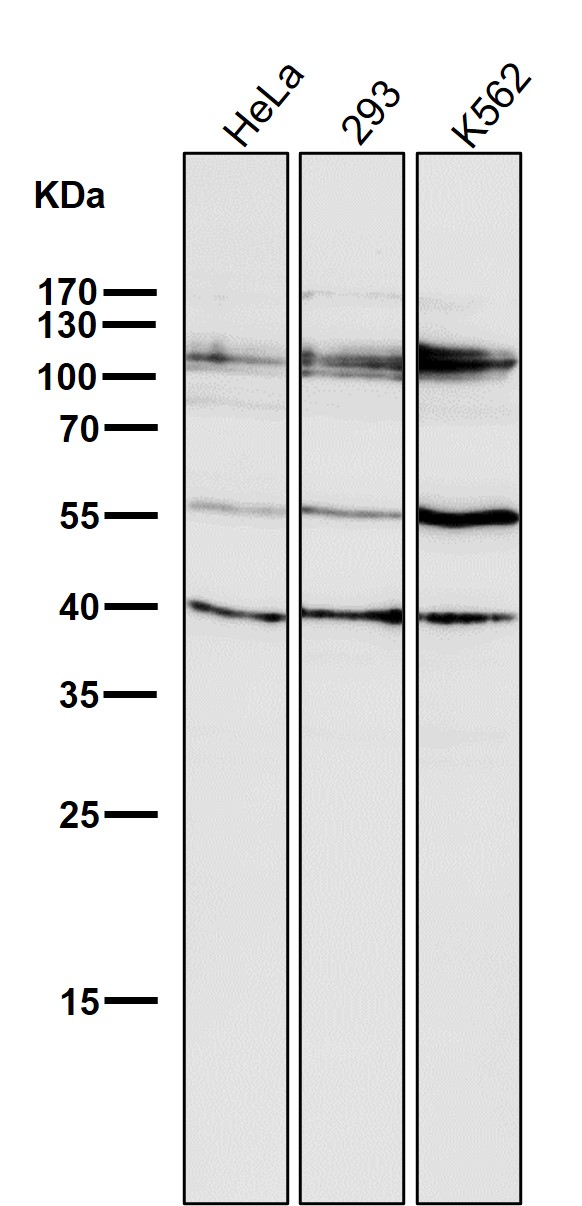 1 - Anti-HDAC7/Histone Deacetylase 7 Rabbit Monoclonal Antibody ABO13700