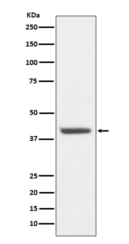 1 - Anti-HDAC8/Histone Deacetylase 8 Rabbit Monoclonal Antibody ABO13701