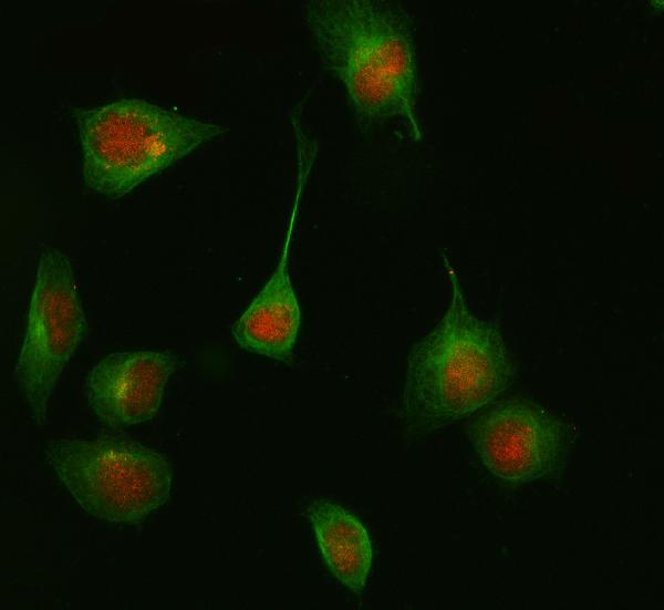 3 - Anti-HDAC8/Histone Deacetylase 8 Rabbit Monoclonal Antibody ABO13701