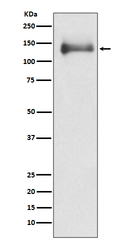 1 - Anti-HDAC4/Histone Deacetylase 4 Rabbit Monoclonal Antibody ABO13702