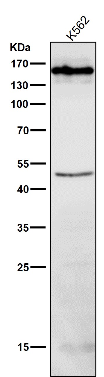 1 - Anti-HDAC4/Histone Deacetylase 4 Rabbit Monoclonal Antibody ABO13702
