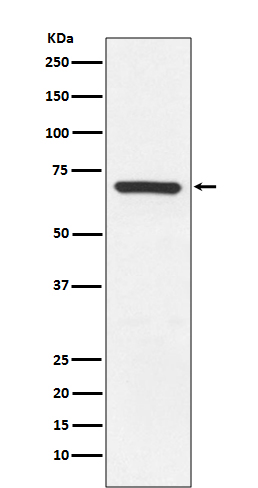 1 - Anti-MEKK3 MAP3K3 Rabbit Monoclonal Antibody ABO13703