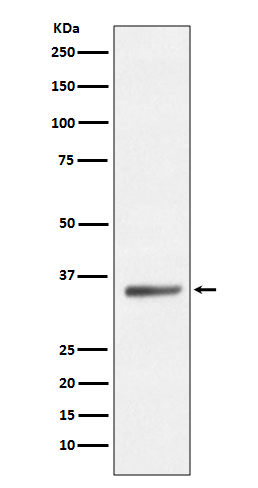 1 - Anti-SIRT5/Sirtuin 5 Rabbit Monoclonal Antibody ABO13704