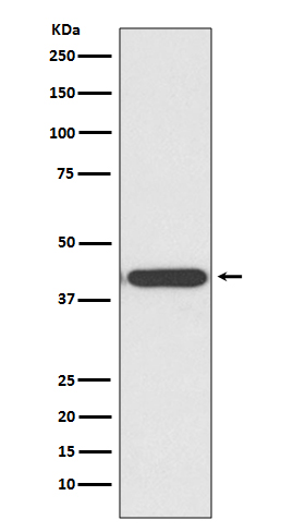 1 - Anti-HDAC8/Histone Deacetylase 8 Rabbit Monoclonal Antibody ABO13705