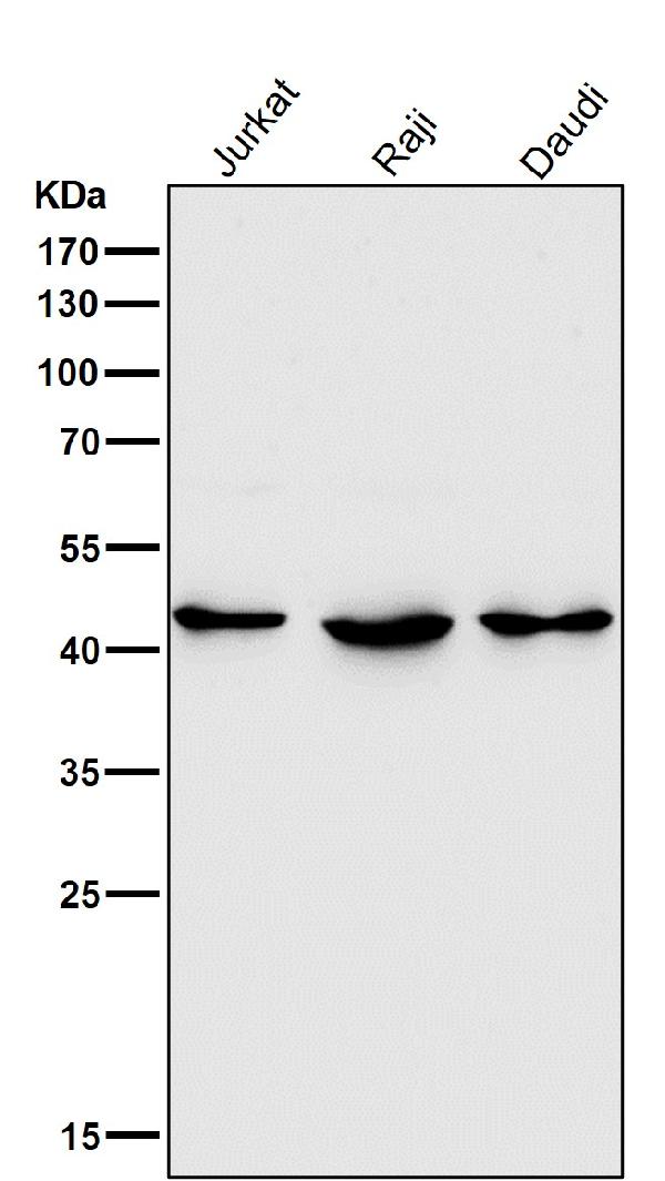 1 - Anti-HDAC8/Histone Deacetylase 8 Rabbit Monoclonal Antibody ABO13705