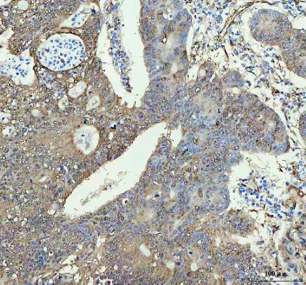 2 - Anti-Hsp27 HSPB1 Rabbit Monoclonal Antibody ABO13706