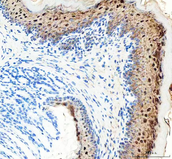 2 - Anti-Hsp27 HSPB1 Rabbit Monoclonal Antibody ABO13706