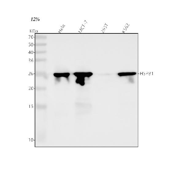 1 - Anti-Hsp27 HSPB1 Rabbit Monoclonal Antibody ABO13706