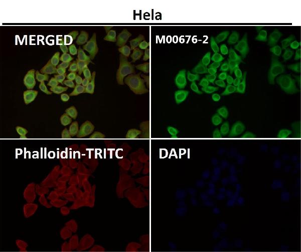 1 - Anti-Hsp27 HSPB1 Rabbit Monoclonal Antibody ABO13706