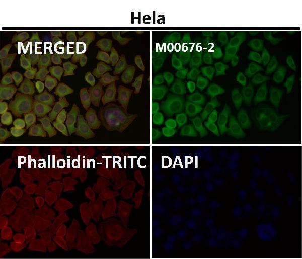 1 - Anti-Hsp27 HSPB1 Rabbit Monoclonal Antibody ABO13706