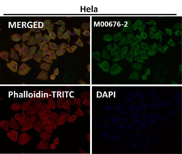 1 - Anti-Hsp27 HSPB1 Rabbit Monoclonal Antibody ABO13706