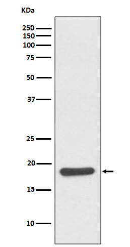 1 - Anti-Hsp20 Rabbit Monoclonal Antibody ABO13711