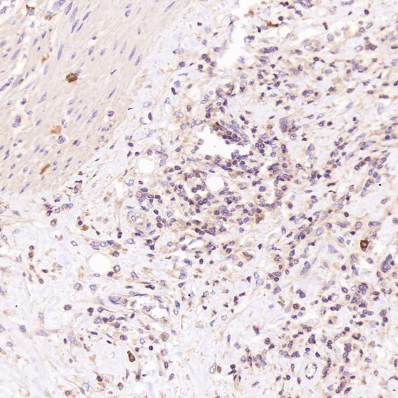 2 - Anti-CDC42 Rabbit Monoclonal Antibody ABO13712