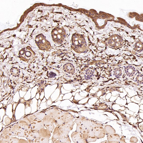 2 - Anti-CDC42 Rabbit Monoclonal Antibody ABO13712