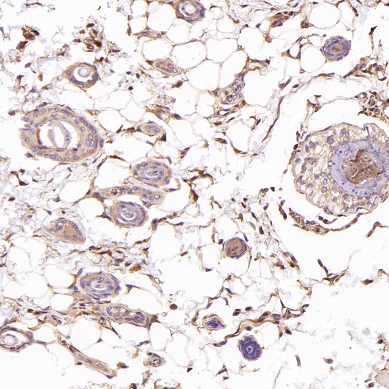 2 - Anti-CDC42 Rabbit Monoclonal Antibody ABO13712