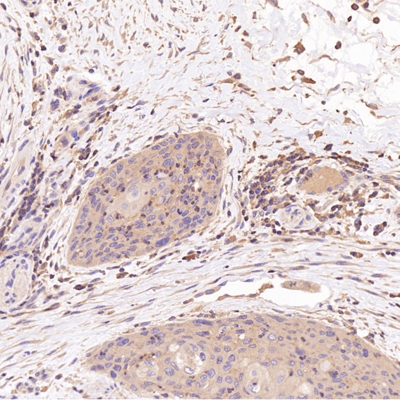 2 - Anti-CDC42 Rabbit Monoclonal Antibody ABO13712