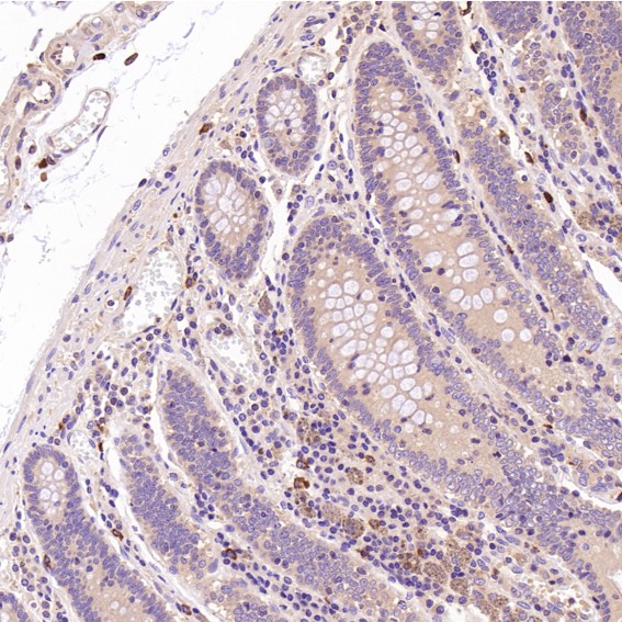 2 - Anti-CDC42 Rabbit Monoclonal Antibody ABO13712