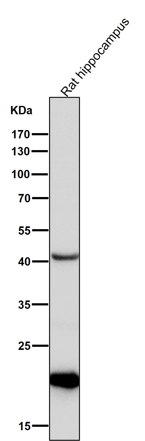 1 - Anti-CDC42 Rabbit Monoclonal Antibody ABO13712