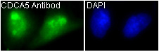 3 - Anti-CDCA5/Sororin Rabbit Monoclonal Antibody ABO13714