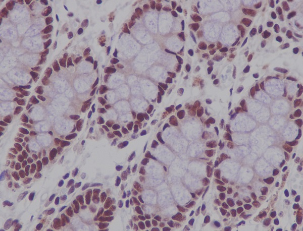 2 - Anti-CDCA5/Sororin Rabbit Monoclonal Antibody ABO13714