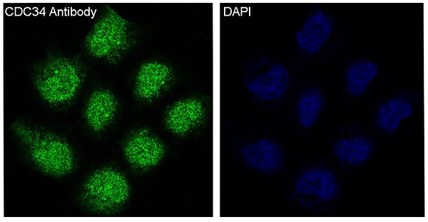 3 - Anti-CDC34/Ubch3 Rabbit Monoclonal Antibody ABO13715