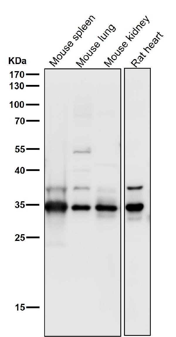 1 - Anti-CDC34/Ubch3 Rabbit Monoclonal Antibody ABO13715