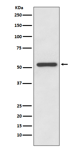 1 - Anti-MMP13 Rabbit Monoclonal Antibody ABO13720