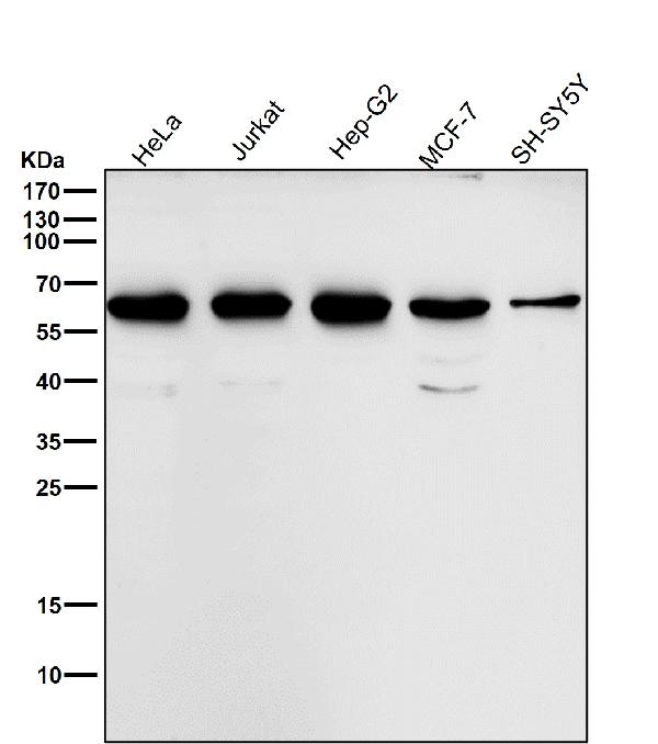 1 - Anti-MMP13 Rabbit Monoclonal Antibody ABO13720
